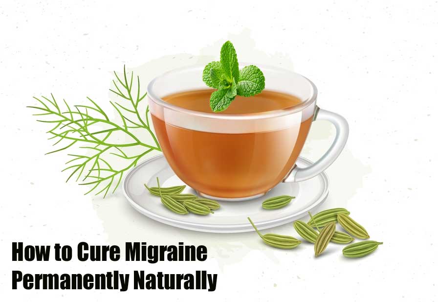 How to Cure Migraine Permanently Naturally