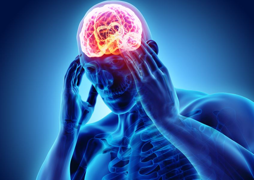 Migraine Lasting Weeks: Discover Effective Remedies